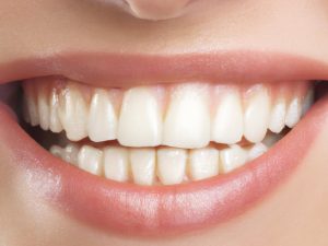 For tartar on teeth removal, you should consult a dentist.